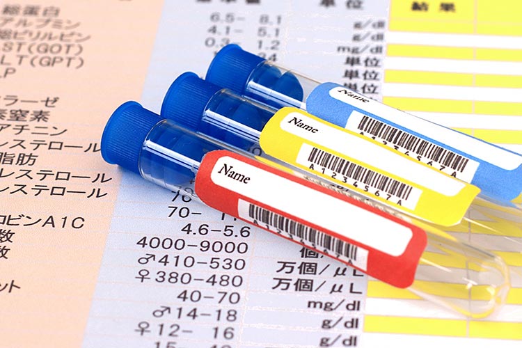 糖尿病のイメージ写真